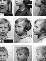 Black and white photo divided into 9 small pictures of sad children faces taken in profile and en face.