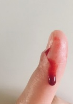 Zdjęcie palca, na nim kropla krwi.