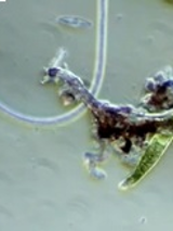 Zdjęcie mikroskopowe przedstawiające nieregularne kształty na szarym tle.