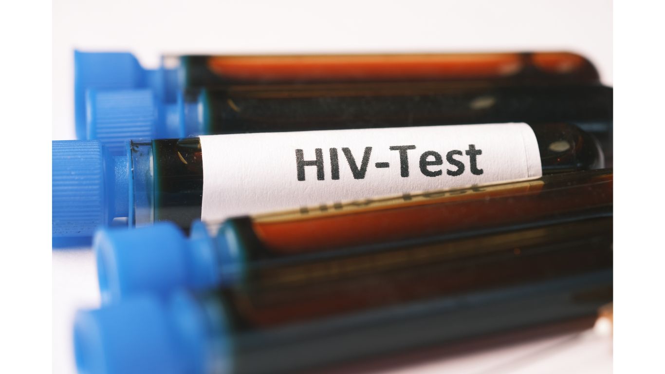 HIV/AIDS Na zdjęciu fiolki z krwia do badania opisane hiv test