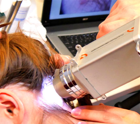 badanie znamion dermatoskopem