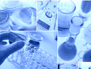 Naukowcy z AWF w Poznaniu poprowadzą badania nad stwardnieniem zanikowym bocznym